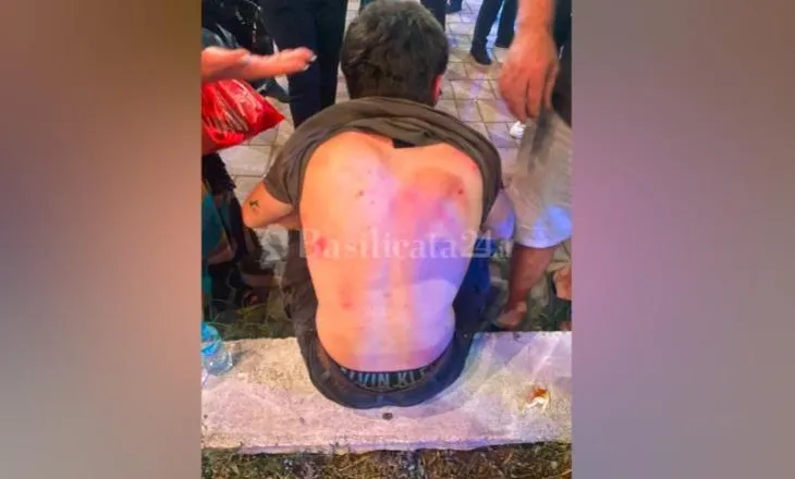 Erdhën për pushime, 6 italianë dhunohen nga një grup shqiptarësh në Tiranë: Na kërcënuan me thikë për të na marrë…