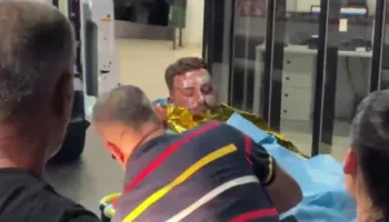 Identifikohen katër të plagosurit nga zjarri në skafin në Porto Palermo, një prej tyre me 50% të trupit të djegur