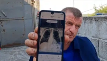 Me brinjë të dëmtuara e ilaçe në xhep, zjarrfikësi s’e braktis detyrën/ 5 ditë pa gjumë, komandanti: Do të rrimë derisa të shuhet vatra e fundit
