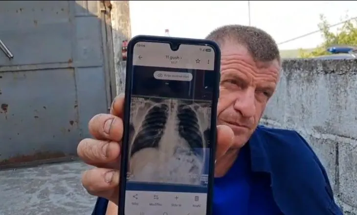 Me brinjë të dëmtuara e ilaçe në xhep, zjarrfikësi s’e braktis detyrën/ 5 ditë pa gjumë, komandanti: Do të rrimë derisa të shuhet vatra e fundit