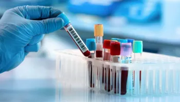 Një pacient, disa laboratorë/ A japin të njëjtën përgjigje për të njëjtin gjak?
