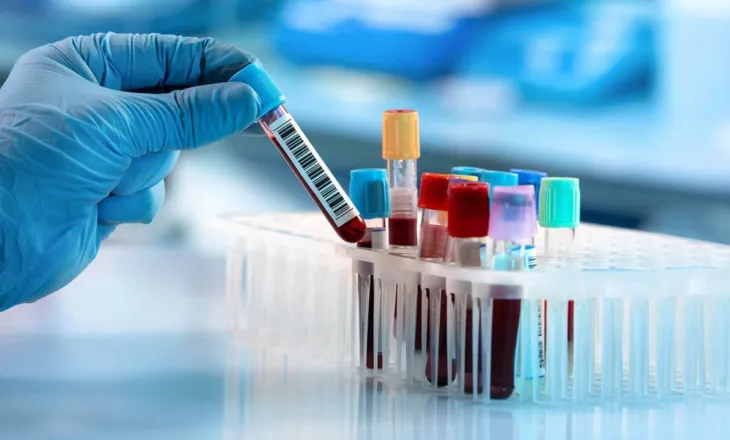 Një pacient, disa laboratorë/ A japin të njëjtën përgjigje për të njëjtin gjak?