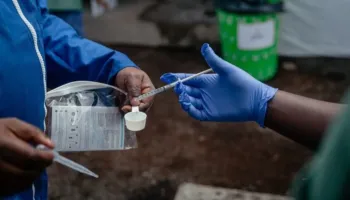 OKB ndan 3 milionë $ për përgatitjen për Ebolën në Republikën e Afrikës Qendrore