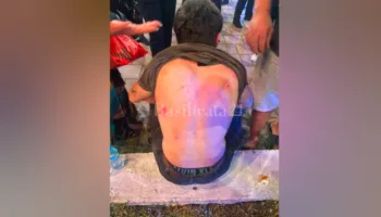 Pamje të rënda/ Dhunohen barbarisht turistët italianë në Tiranë: Kërkuam ndihmë, por bënin sikur nuk na shihnin