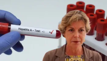 Për herë të parë, Shqipëria miraton Planin Kombëtar për Eliminimin e Hepatiteve Virale! Sala: Më shumë jetë të mbrojtura