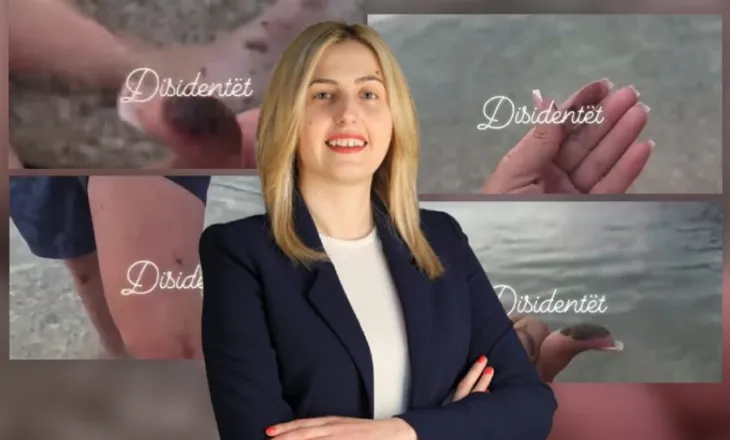 “Plazhistët dalin nga deti me njolla në trup”/ Zhupa ngre shqetësimin: Ku janë institucionet, apo kanë ikur me pushime