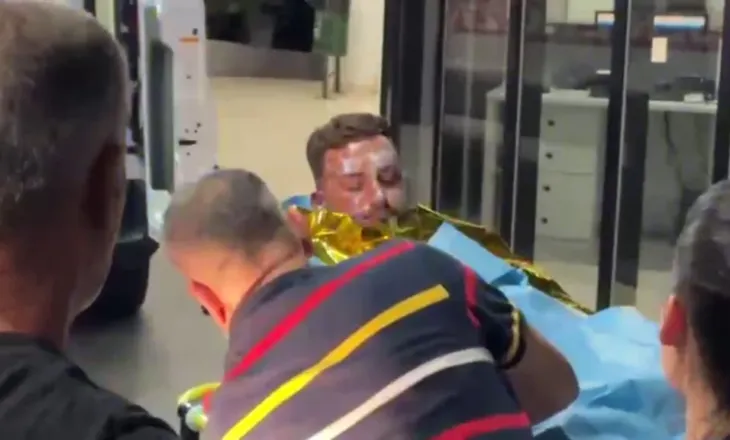 Shpërthen motori i skafit në Porto Palermo, 4 të plagosur. Dy prej tyre me djegie të rënda në trup