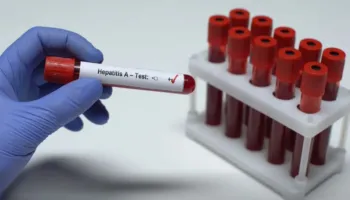 Shqipëria miraton për herë të parë planin kombëtar kundër hepatiteve virale, Rama: Synimi, parandalimi i rasteve të reja dhe ulja e kancerit të mëlçisë