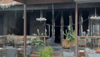 Zjarri në hotelin e Vlorës, Ministria e Shëndetësisë për të lënduarit: Një paciente në gjendje të rënduar nga djegiet