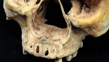Grua pa hundë – Skeleti tregon ndëshkimin e tmerrshëm në Kinën mesjetare
