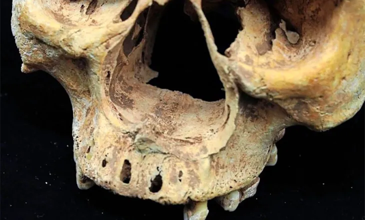 Grua pa hundë – Skeleti tregon ndëshkimin e tmerrshëm në Kinën mesjetare