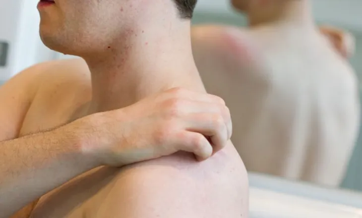 ‘Kalbja e shiut’ – Një sëmundje shtazore që përhapet nëpër saunat e seksit në Evropë?