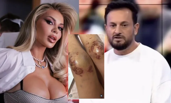 “Luana Vjollca ka paguar për të rrahur një vajzë”/ Deklarata e fortë e Elton Tozajt
