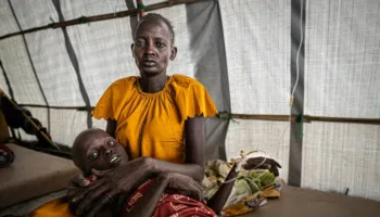 OBSH ngre alarmin për kolerën: Më pak raste, por 30% më shumë vdekje që nga ’99
