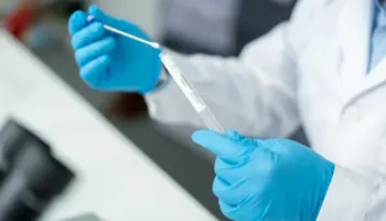 Shumë gra po e ngatërrojnë këtë infeksion seksual me dhimbjet e ciklit