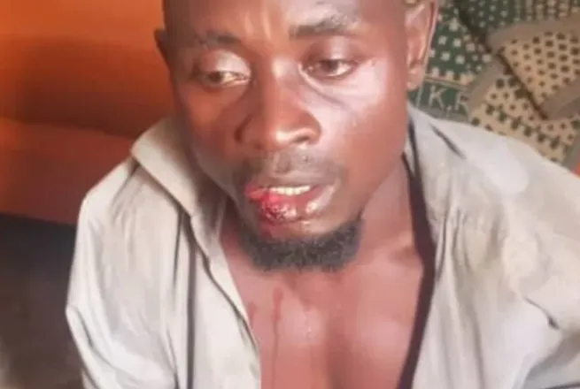 15 vite në arrati, arrestohet në Ugandë i dyshuari për vrasjen e 38 personave dhe kanibalizëm