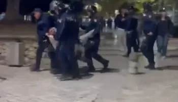 19-vjeçarit i thyen këmbën, reagon Policia e Shtetit, pezullon 4 efektivë dhe shefin e komisarit nr.1