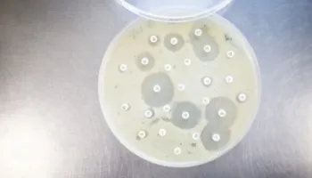 Agjencia amerikane e shëndetësisë: Po monitorojmë rastin e dyshuar të murtajës pneumonike në Rusi