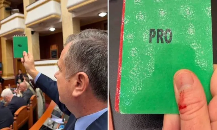 Balla me gishtin e gjakosur i përgjigjet Berishës: Dhuna nuk e ndal dot agjendën europiane