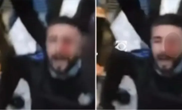 Dhuna barbare në protestë/ U godit nga policia me plumb gome, i riu humb shikimin në syrin e majtë