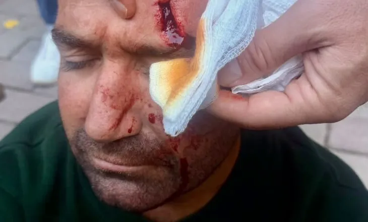 Dhuna e policisë ndaj studentëve, reagon Ambasada Gjermane