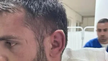 Dhunohet në krye të detyrës gazetari Izmir Akulli, përfundon në QSUT