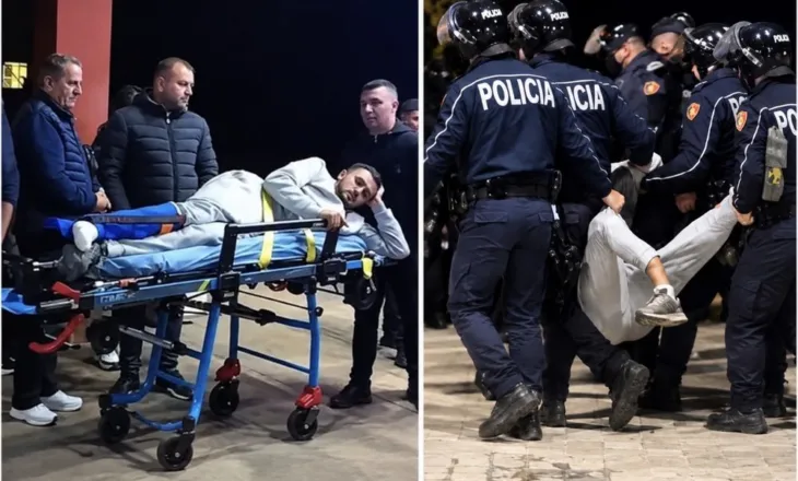 E dhunuan edhe pasi ia thyen këmbën, 19-vjeçari i nënshtrohet ndërhyrjes kirurgjikale