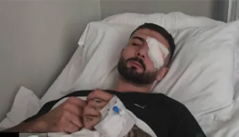 “E kanë çuar famija, miqtë dhe mbeshtetesit”, familja e Erjon Vishkullit, përgenjeshtron Ramën për të plagosurin