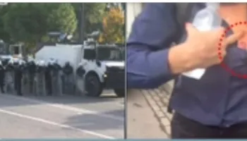 E rëndë/ Policia e Ramës qëllon me plumb gome në gjoks profesoreshën, doli të ndihmonte studentët