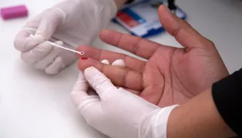 ‘Epidemi e përhapur gjerësisht’: Mbi 3% e burrave rusë të moshës 40-50 vjeç janë të prekur nga HIV-i