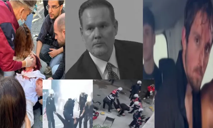 Ervin Demo fytyra e dhunës, pedagogu që sot gjakosi studentët si Ministër i Brendshëm