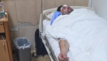 FOTO/ Tjetër pamje e rëndë, studenti i masakruar nga policia, në gjendje të rëndë tek Trauma