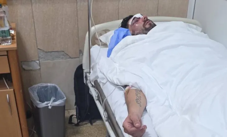 FOTO/ Tjetër pamje e rëndë, studenti i masakruar nga policia, në gjendje të rëndë tek Trauma