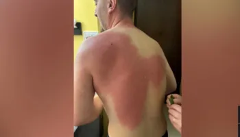 FOTOLAJM/ Policia nuk ndalet, u sulet edhe mediave me ujë me piper. Dëmtohet gazetari Klevi Muka