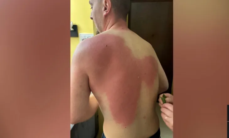 FOTOLAJM/ Policia nuk ndalet, u sulet edhe mediave me ujë me piper. Dëmtohet gazetari Klevi Muka