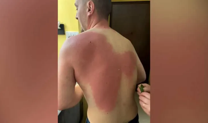 Gazetari Klevin Muka u lëndua nga uji me solucion, Berisha dënon sulmin: Akt kriminal dhe hakmarrje primitive