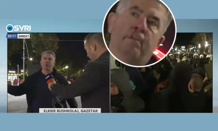 Grusht fytyrës fotoreporterit për median e huaj, gazetari i gjakosur: Poshtë komunizmi! Do e paguajnë
