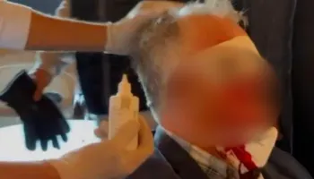 Horror/ PAMJE TË RËNDA / Përgjaket protesta te Kryeministria! Qëllohet në fytyrë me gëzhojën e gazit lotsjellës, burri i gjakosur ndihmohet nga qytetarët