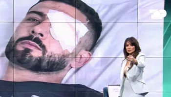 I plagosuri në protestë, Erjon Vishkulli do të operohet nesër në spitalin ku u operua dhe Papa Leone