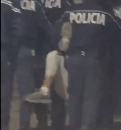 Identifikohet protestuesi që policia i theu këmbën