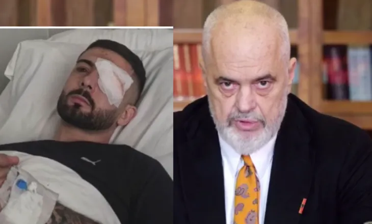 “Ju ia mbyllët dritën e syrit”/ Rama reagon për pagosjen e 28-vjeçarit: U kujdesa personalisht për kurimin e tij në Itali