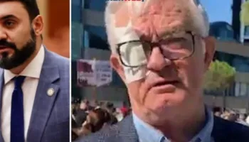 Kryeministri më i korruptuar në Europë”, Këlliçi poston foton: Pse Rama nuk e sheh këtë plagë në fytyrën e pedagogut?