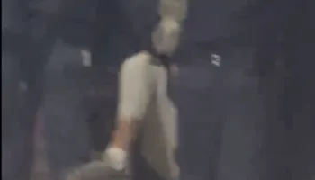 KUJDES PAMJE TË RËNDA!!!/ Policia i thyen këmbën dhe e tërheq zvarrë, studenti ne koma
