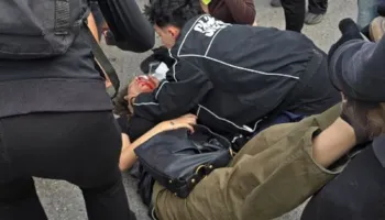 KUJDES! PAMJE TË RËNDA!! Protestuesja goditet nga gazi lotsjellës në fytyrë