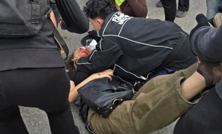 KUJDES! PAMJE TË RËNDA!! Protestuesja goditet nga gazi lotsjellës në fytyrë