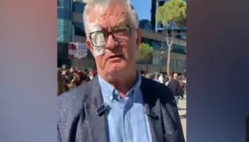 Larg duart nga studentët”/ Profesori që rrezikoi syrin nga plumbi i gomës së policisë, mesazh të fortë Ramës nga protesta: Largohu! E kemi zgjidhur kontratën me ty