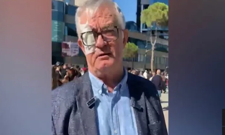 Larg duart nga studentët”/ Profesori që rrezikoi syrin nga plumbi i gomës së policisë, mesazh të fortë Ramës nga protesta: Largohu! E kemi zgjidhur kontratën me ty