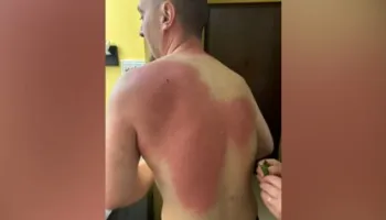 Lëndimi i gazetarit Klevin Muka, reagon SafeJournalists: Kërkojmë hetim të pavarur dhe llogaridhënie për veprimet e Policisë