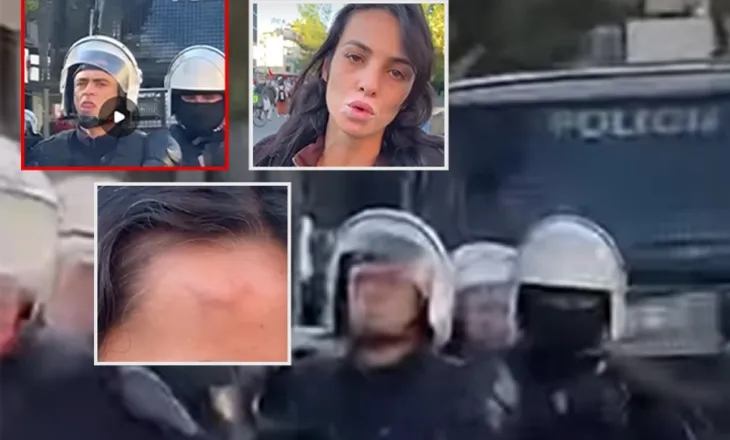 ‘Më dhunuan me shkop gome, ndërkohë që nuk po bëja asgjë’/ Dëshmia e studentes: Më tërhoqën më futën në….