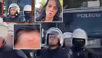 Më gjuajti me shkop gome…”/ Studentja: Si u dhunova papritur nga polici i FNSH